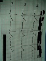 20170318_184526.jpg