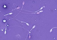 sperm_pic4.jpg