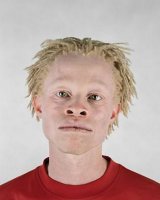 10_Albino_africans-s350x437-1380-580.jpg