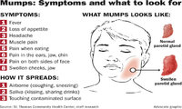 mumps_2.jpg