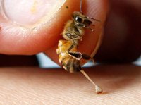 bee-sting-therapy-hp-orig-907x675.jpg