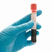 Blood-test-vial-e1559230144874.jpg