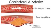 cholesterol2-1024x549.jpg