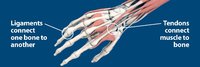 Sudden-Acute-Finger-Hand-Wrist-Injuries-Graphic-2.jpg