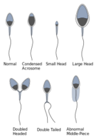 220px-Abnormalsperm.svg.png