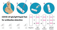 COVID-19IgGIgM-AntibodiesRapidTestdetection.jpg