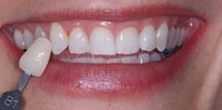 Wycherleys_N1504b-750x371.jpg