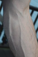 forearm-veins-1.jpg