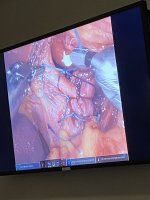 IMG_4737.jpeg