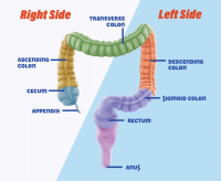 left-sideright-side-colon-graphic-700x572.png