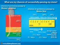 chances-of-stone-passage.jpg