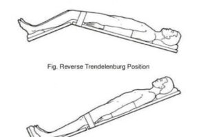 Trendelenburg-vs-Trendelenburg-inverse-618x394.jpg