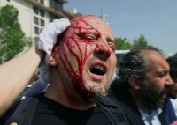 policiska-brutalnost-turcija-02.jpg