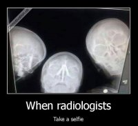 x ray.jpg