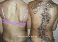 Incredible-Tattoos-Covering-Scars-20.jpg