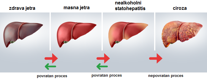 masna-jetra.png