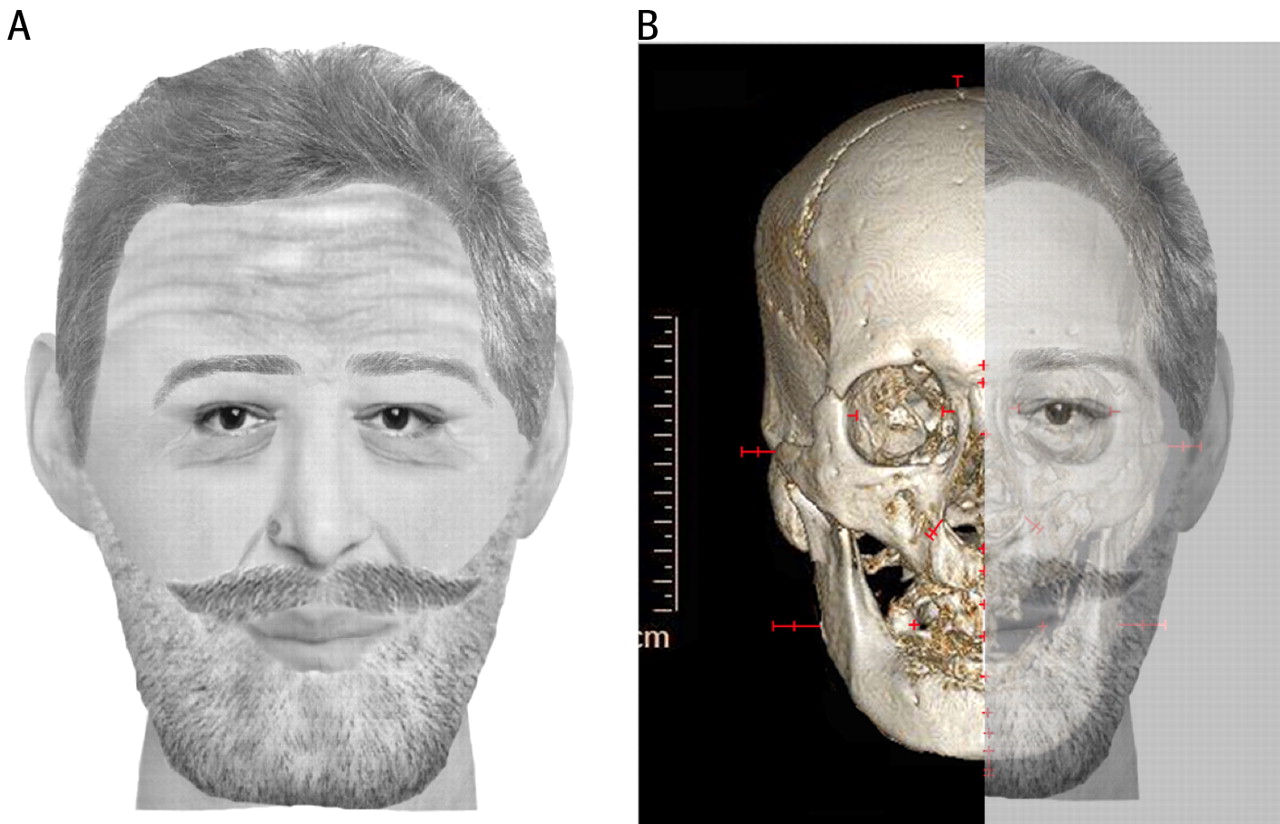henry-reconstruction-101214-02.jpg