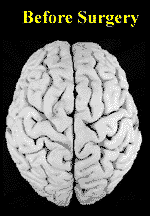 brbrain.gif