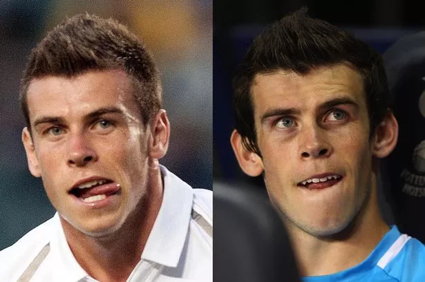 gareth+bale+ears.jpg