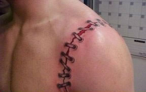 stitches-tatoo-arm.jpg