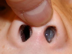 6_smelly-mucus-in-nose-.jpg