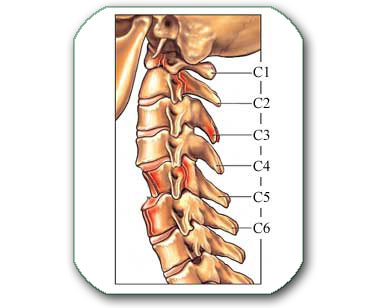 nestabilnost-nakon-preloma.jpg