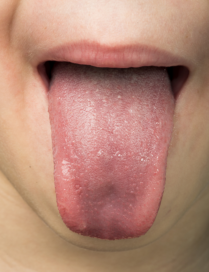 Tongue.jpg