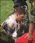 _1989953_injured150afp.jpg