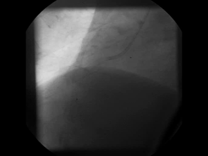 4_ezgif.com-resize.gif